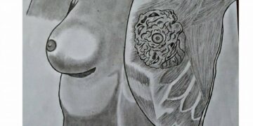 October is Breast Cancer Awareness Month in South Africa!