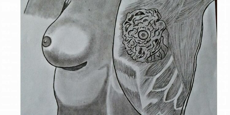 Breast Check Guide – Early Detection can save Lives!