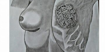 Breast Check Guide – Early Detection can save Lives!