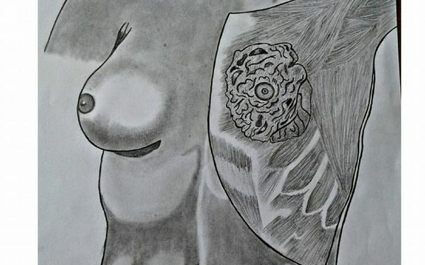 Breast Check Guide – Early Detection can save Lives!