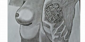 October is Breast Cancer Awareness Month in South Africa!