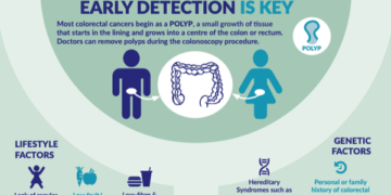 Tips to Cut Your Risk for Top Two Cancers!