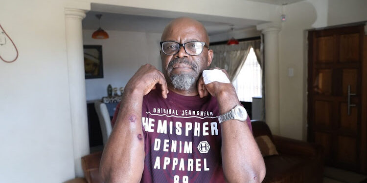 CONDOLENCES TO FAMILY OF VETERAN ACTOR, PATRICK SHAI!