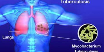 World Tuberculosis Day!