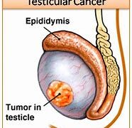 Movember is about men’s health!