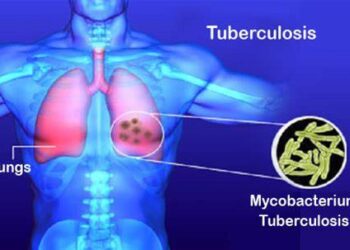 World Tuberculosis Day on 24 March 2025!