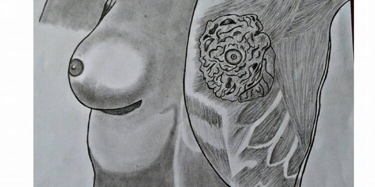 Breast Check Guide – Early Detection can save Lives!