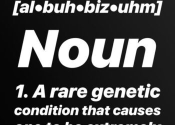 Happy International Albinism Awareness Day