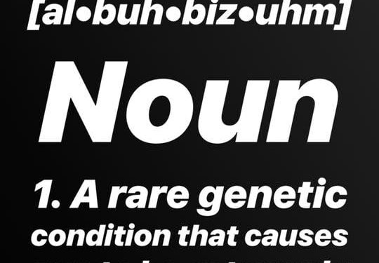 Happy International Albinism Awareness Day