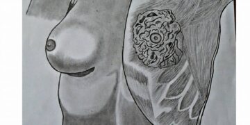 October is Breast Cancer Awareness Month